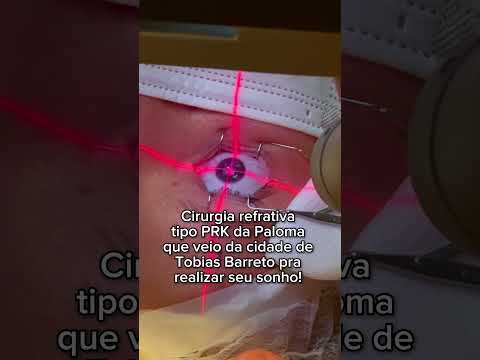 Cirurgia refrativa tipo PRK para correção de miopia e astigmatismo.