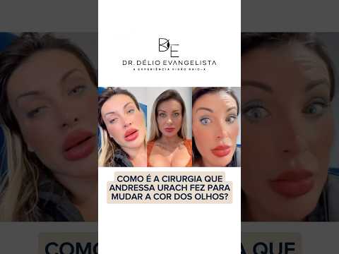 Veja como é a cirurgia que Andressa Urach fez para mudar a cor dos olhos!