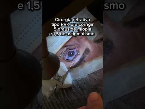 Cirurgia refrativa pra corrigir 5 graus de miopia e 1,5 de astigmatismo