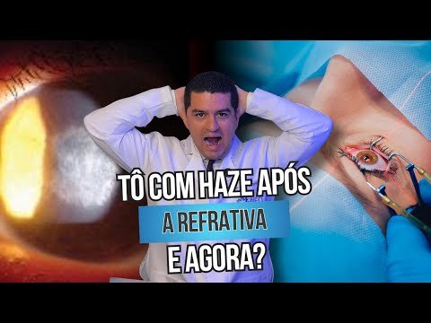 Tô com haze após a refrativa, e agora?
