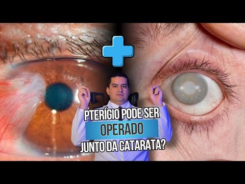 Pterígio pode ser operado junto da catarata?
