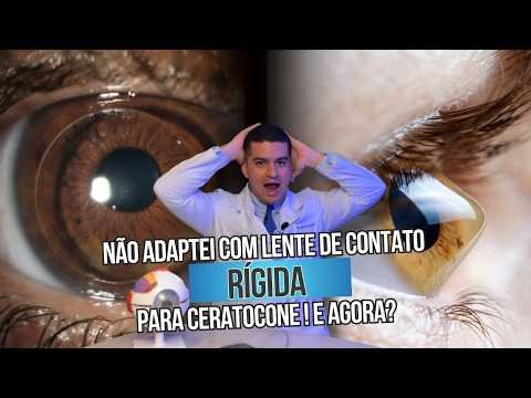 Não me adaptei a lente de contato rígida para ceratocone! E agora?