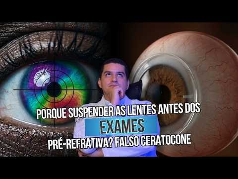 Porque suspender lentes antes dos exames pré refrativa? Falso ceratocone