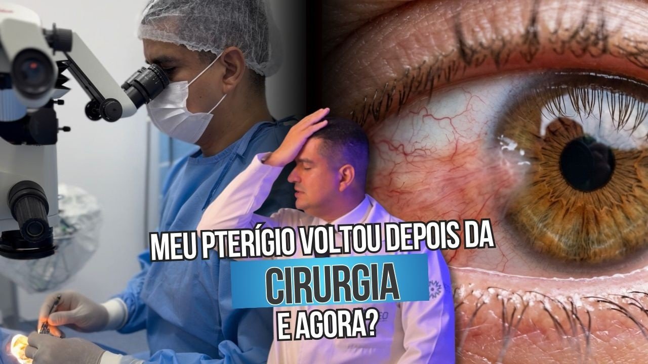 Meu pterígio voltou depois da cirurgia: e agora?