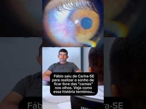 Pterígio: sonho de ficar sem a carne no olho